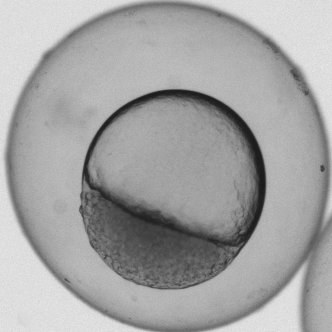 Real zebrafish embryo, brightfield