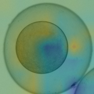 Classifier attention map
